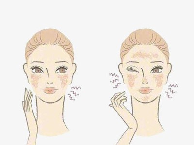 秋季皮膚為何會(huì)過敏？芳香世家告訴你